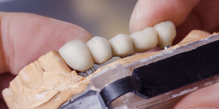 dental technician preparing dental bridge